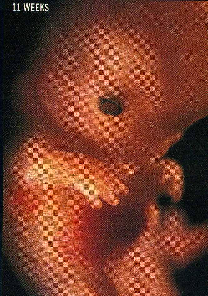 Плод 11 недель фото. 11 Недель беременности фото плода. Плод на 10 неделе беременности. Эмбрион на 11 неделе беременности.